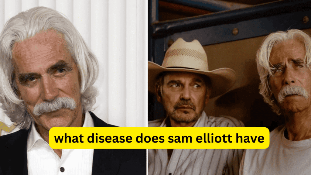 what disease does sam elliott have